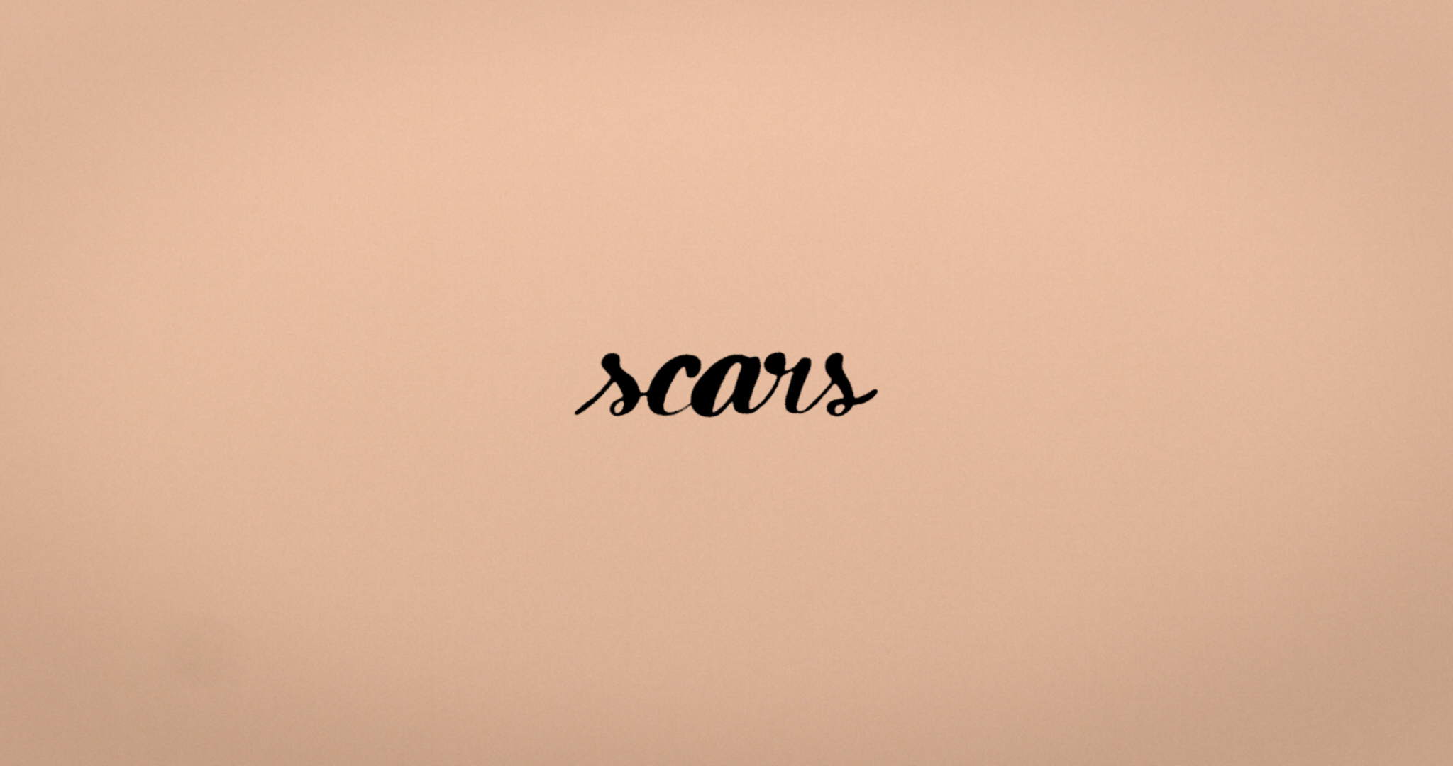 Scars - Alex Anna - 2020